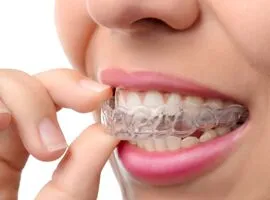 invisalign clear braces